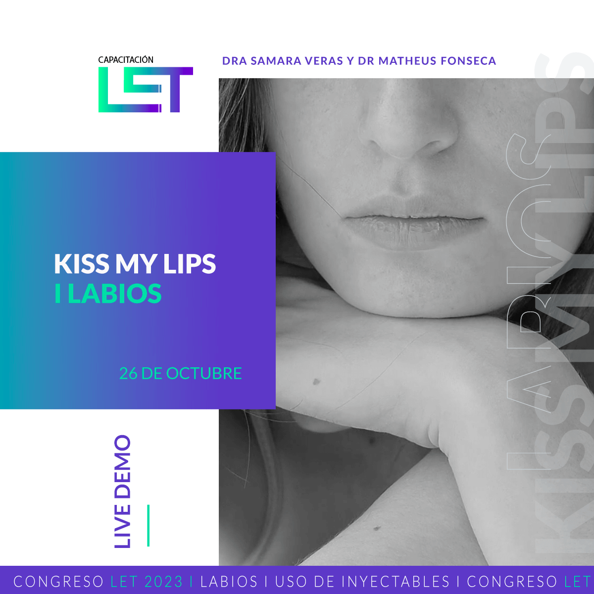 KISS M LIPS